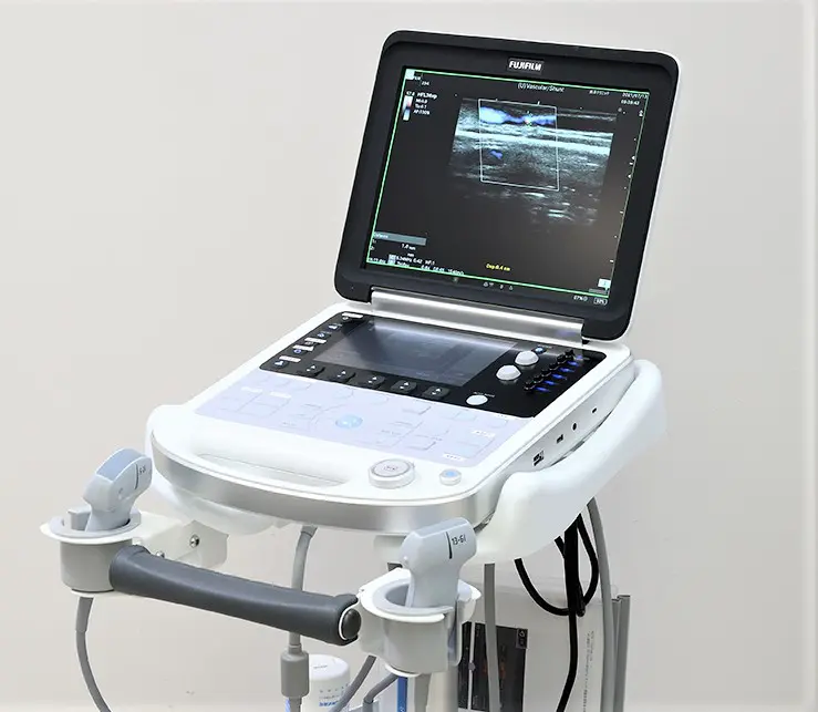 Fujifilm FC1 Ultrasound Machine - Image 2
