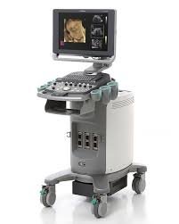 Siemens Acuson X300 Ultrasound System